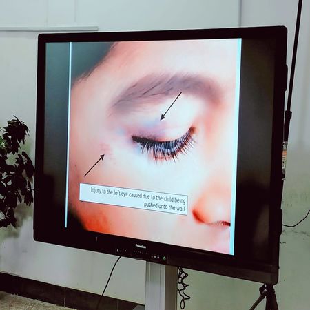 اعلام جامعة بابل - كلية الطب